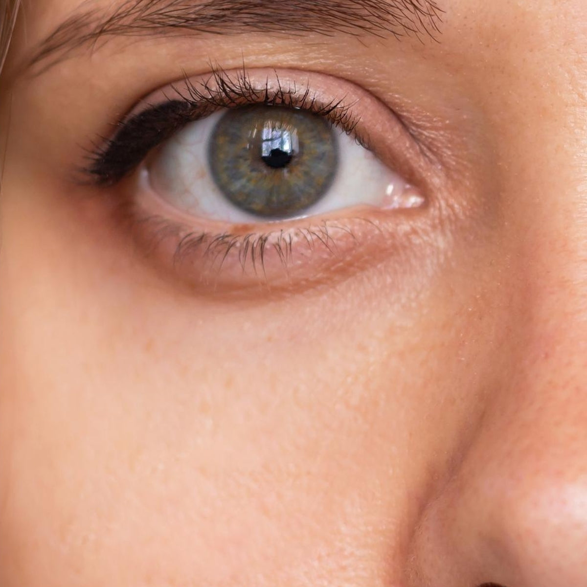 Close-up of an eye after 8 weeks of daily EYLUME Calm Heated Eye Mask use, showing smoother, brighter skin and reduced dark circles